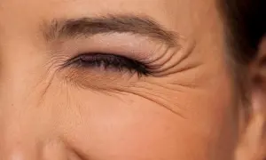 Primer plano de un ojo con maquillaje, mostrando las arrugas debajo de los ojos que se acentúan al sonreír.