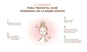 Ilustración de mujer con consejos para el acné hormonal en mujeres adultas: identificar causas, usar cosméticos, estilo de vida, tratamientos tópicos y sistémicos.