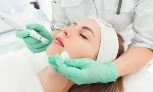 Una esteticista aplica un tratamiento facial con un dispositivo de microagujas, mostrando los beneficios de la mesoterapia para una piel radiante.