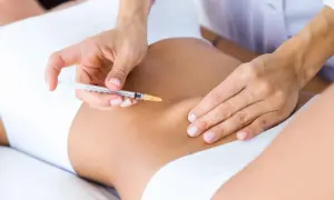 Manos expertas aplican carboxiterapia corporal con jeringa en la zona abdominal para mejorar la piel.