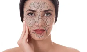 Rostro de mujer con piel agrietada, simulando el daño del estrés oxidativo.