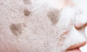 Primer facial agrietado y seco, con parches oscuros, que simula una barrera cutánea dañada.