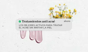 Tratamientos anti acné para quitar granos de la cara. Descubre los mejores activos para tratar el acné sin irritar la piel.
