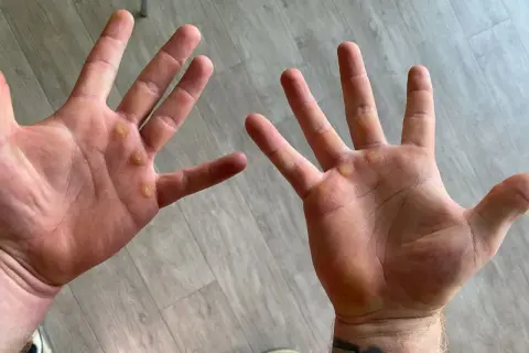 Manos con callos visibles, evidencia de trabajo duro o entrenamiento.