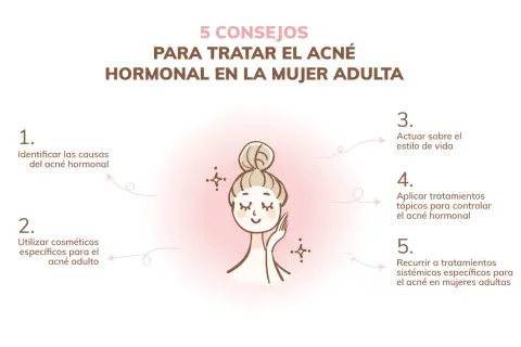 Ilustración de mujer con consejos para el acné hormonal en mujeres adultas: identificar causas, usar cosméticos, estilo de vida, tratamientos tópicos y sistémicos.