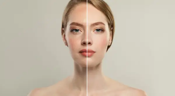 Comparativa de diatermia facial antes y después: piel más lisa y luminosa.