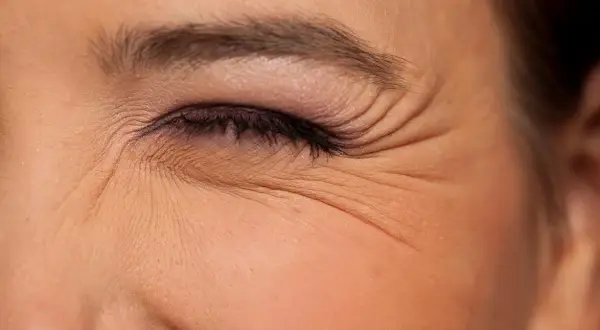 Primer plano de un ojo con maquillaje, mostrando las arrugas debajo de los ojos que se acentúan al sonreír.