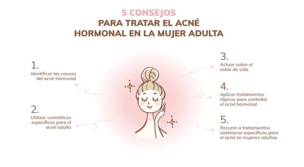 Ilustración de mujer con consejos para el acné hormonal en mujeres adultas: identificar causas, usar cosméticos, estilo de vida, tratamientos tópicos y sistémicos.