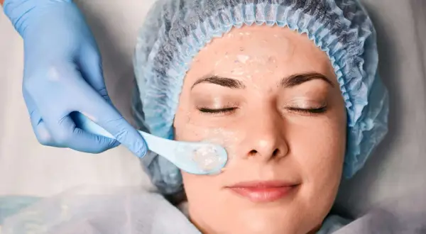 Una mano enguantada aplica una mascarilla en el rostro de una mujer, parte de un tratamiento de peeling químico para renovar la piel.