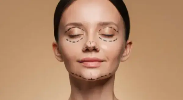Mujer con líneas de marcador en el rostro, indicando áreas para cirugía estética. Se busca corregir la asimetría facial para una apariencia más armoniosa.