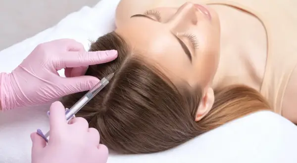 Una persona recibe mesoterapia capilar. El número de cuantas sesiones de mesoterapia capilar son necesarias varía según el caso.