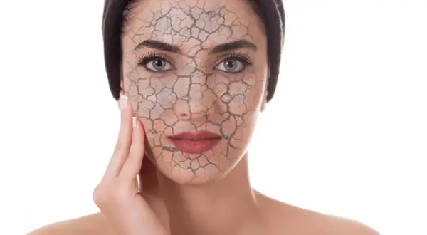 Rostro de mujer con piel agrietada, simulando el daño del estrés oxidativo.