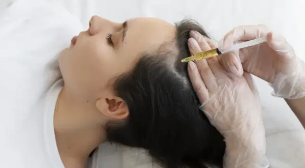 Mujer recibiendo mesoterapia capilar. Una mano enguantada aplica una inyección en el cuero cabelludo para estimular el crecimiento del cabello.