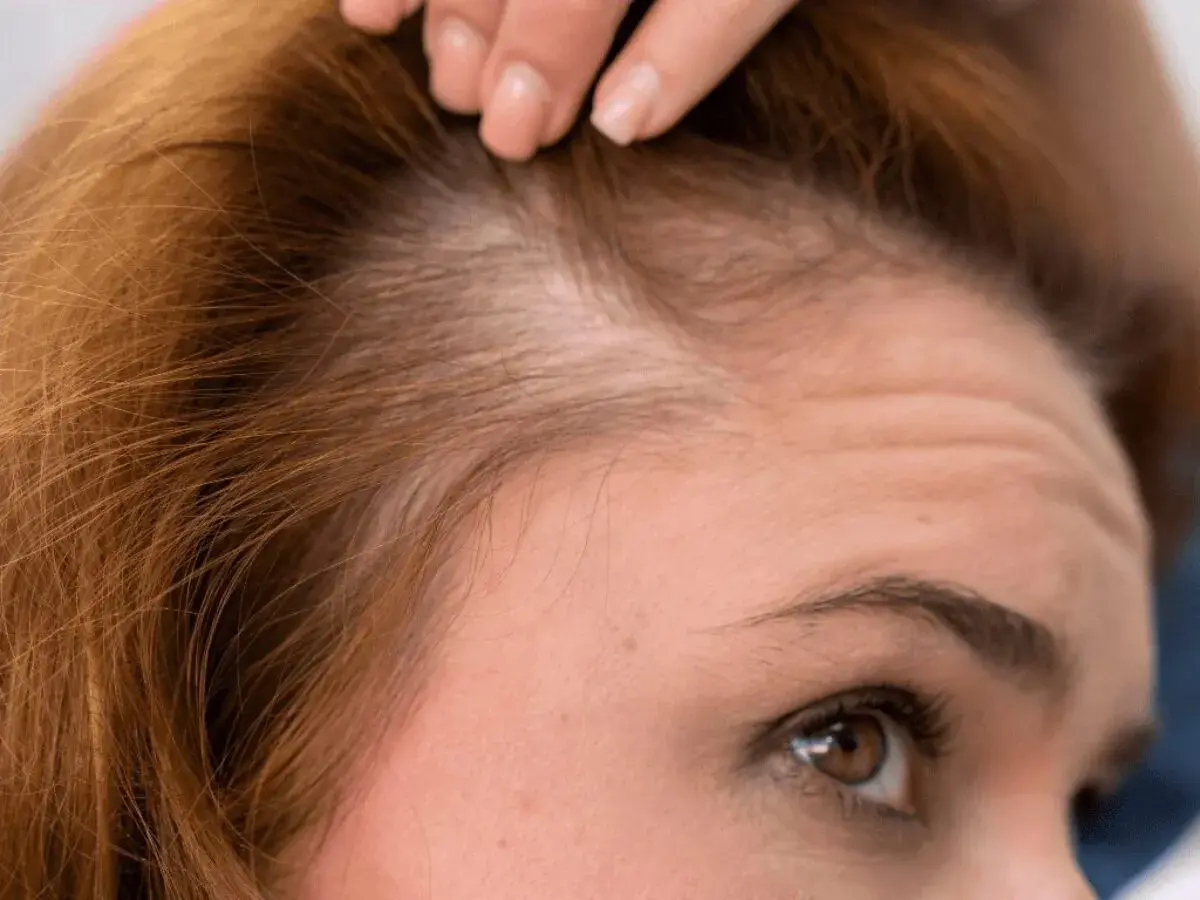 Primer plano de una mujer examinando su cuero cabelludo, preocupada por la caida de pelo.