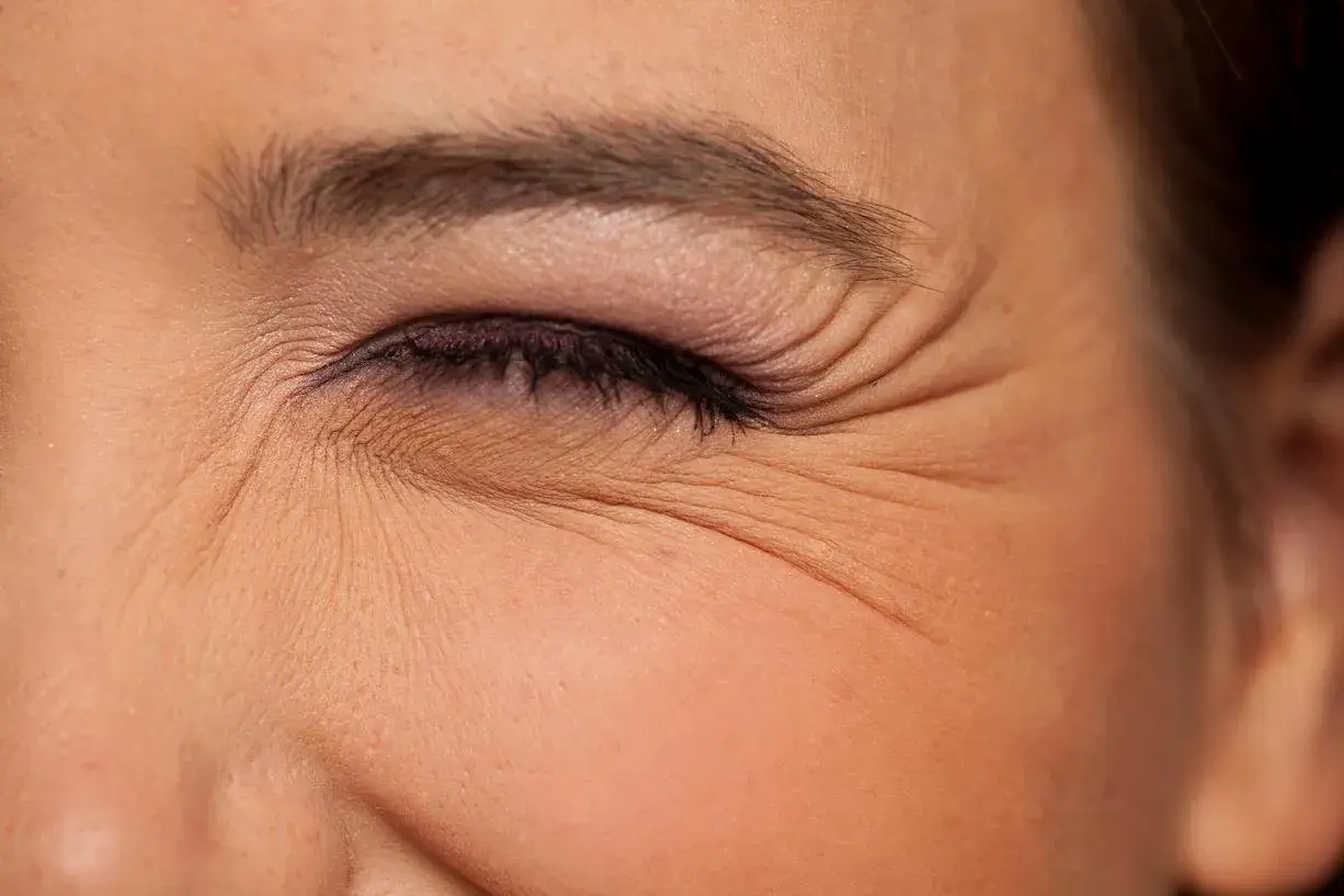 Primer plano de un ojo con maquillaje, mostrando las arrugas debajo de los ojos que se acentúan al sonreír.