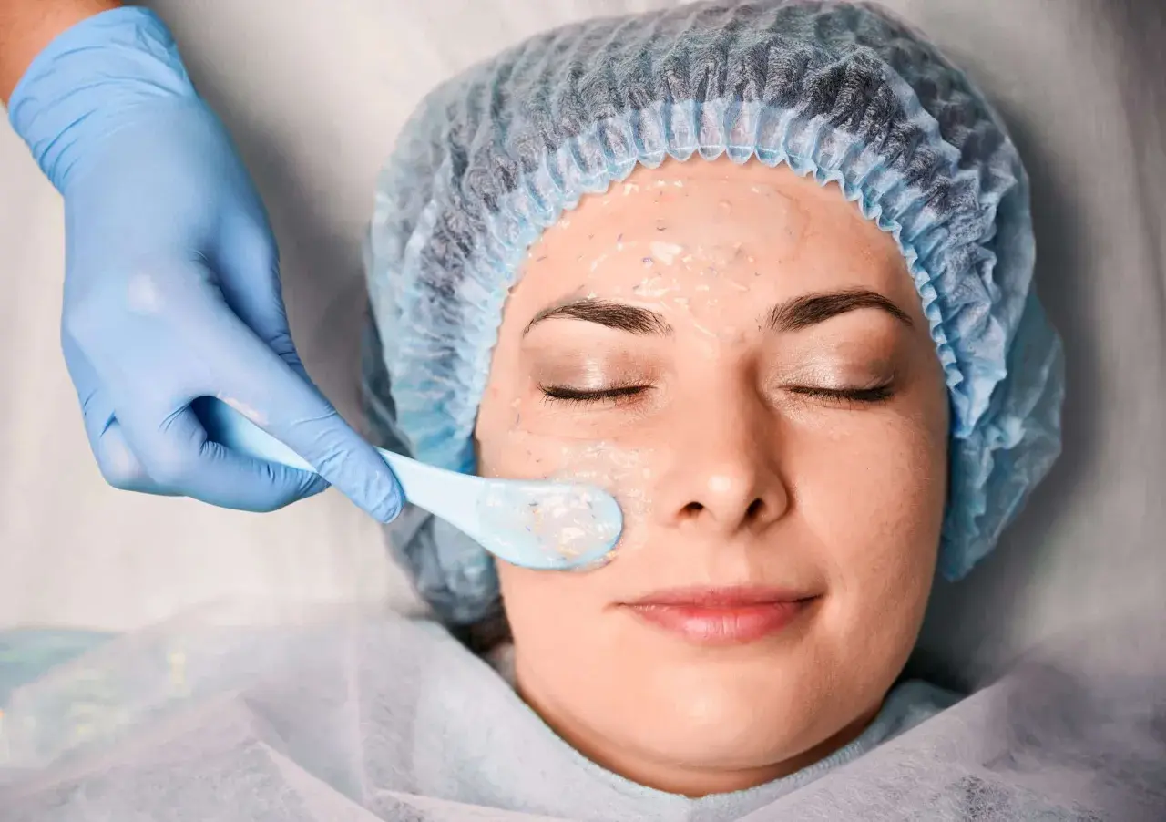Una mano enguantada aplica una mascarilla en el rostro de una mujer, parte de un tratamiento de peeling químico para renovar la piel.