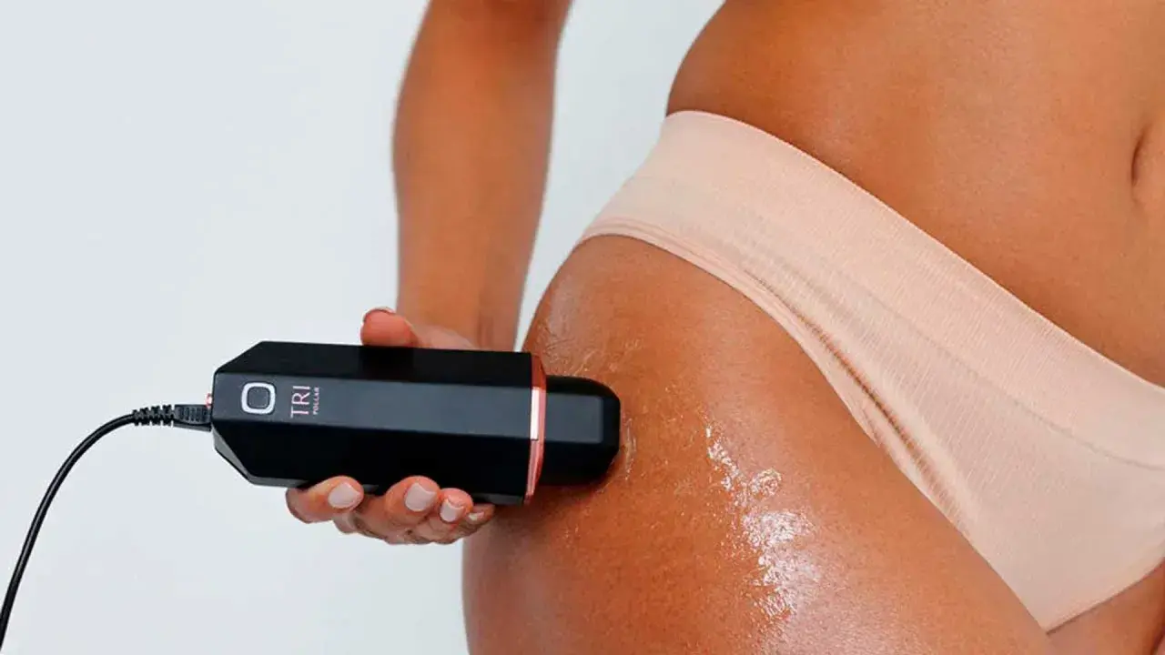 Tratamiento de radiofrecuencia para celulitis en muslo. Dispositivo de belleza en uso.