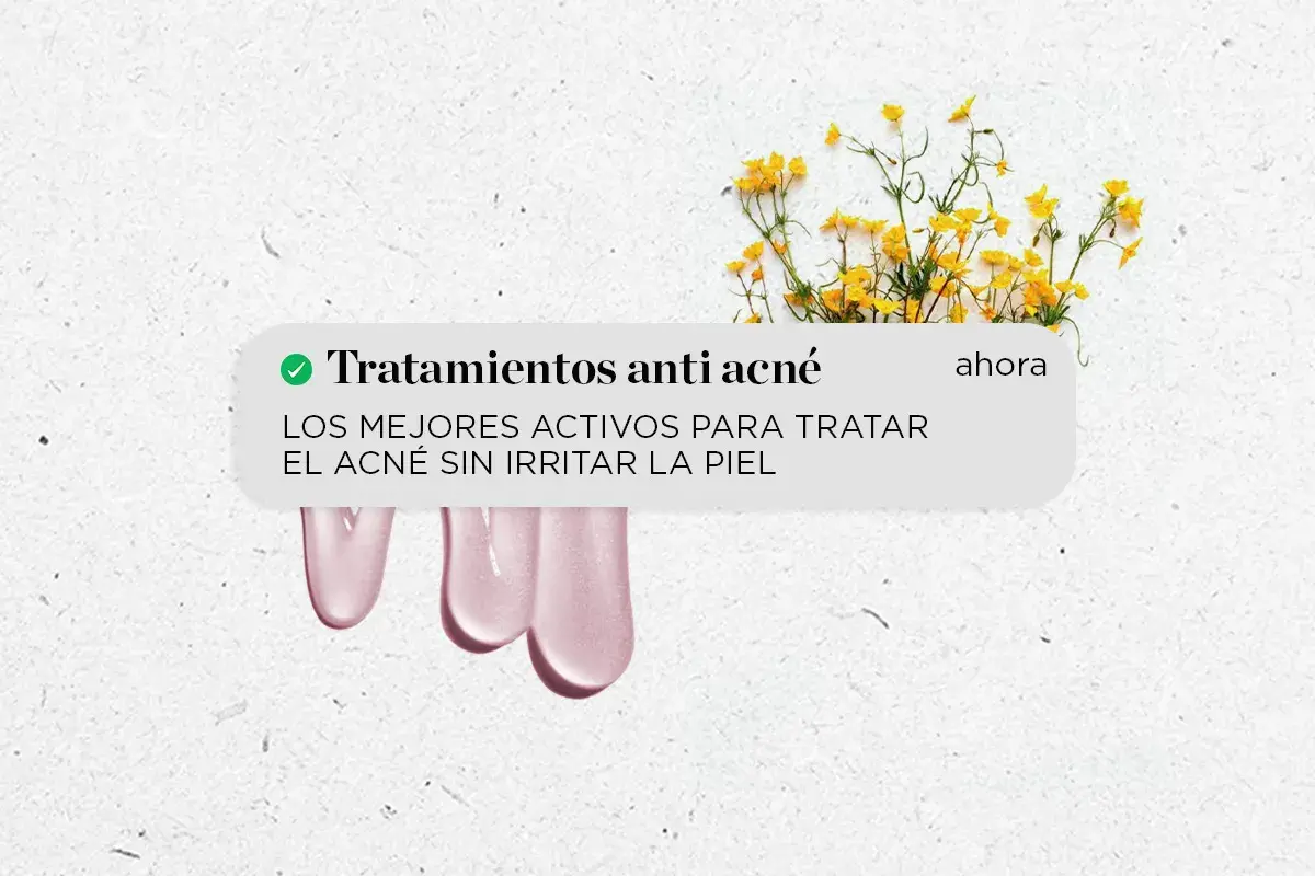 Tratamientos anti acné para quitar granos de la cara. Descubre los mejores activos para tratar el acné sin irritar la piel.