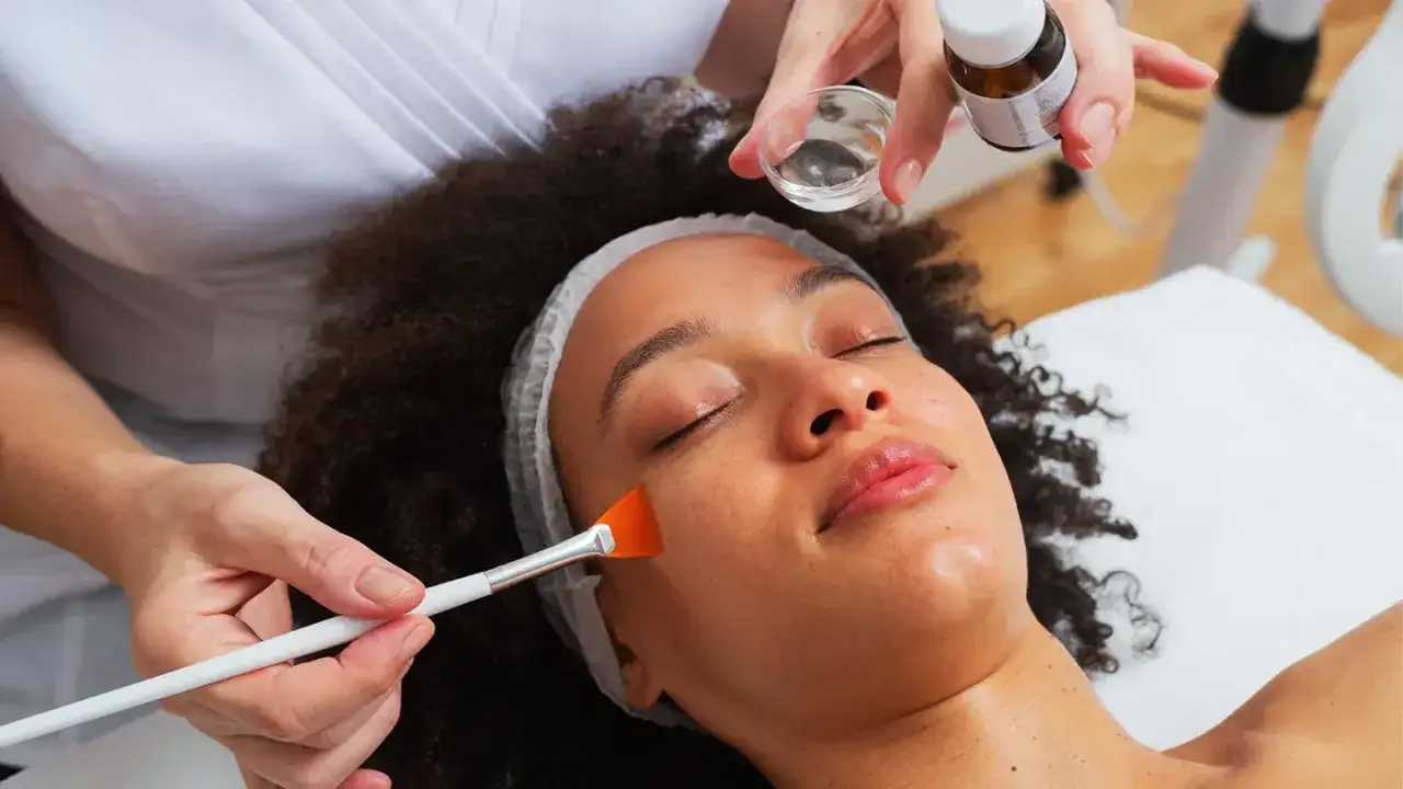 Profesional aplica un peeling químico en el rostro de una mujer. El tratamiento busca renovar la piel.