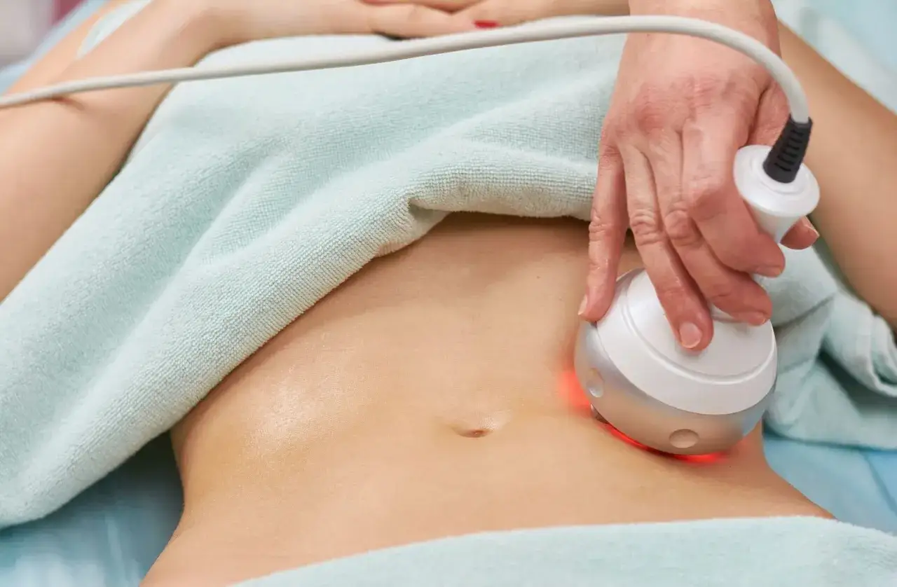 Tratamiento est&eacute;tico en abdomen con dispositivo RF. Buscando opiniones sobre este rf body device.