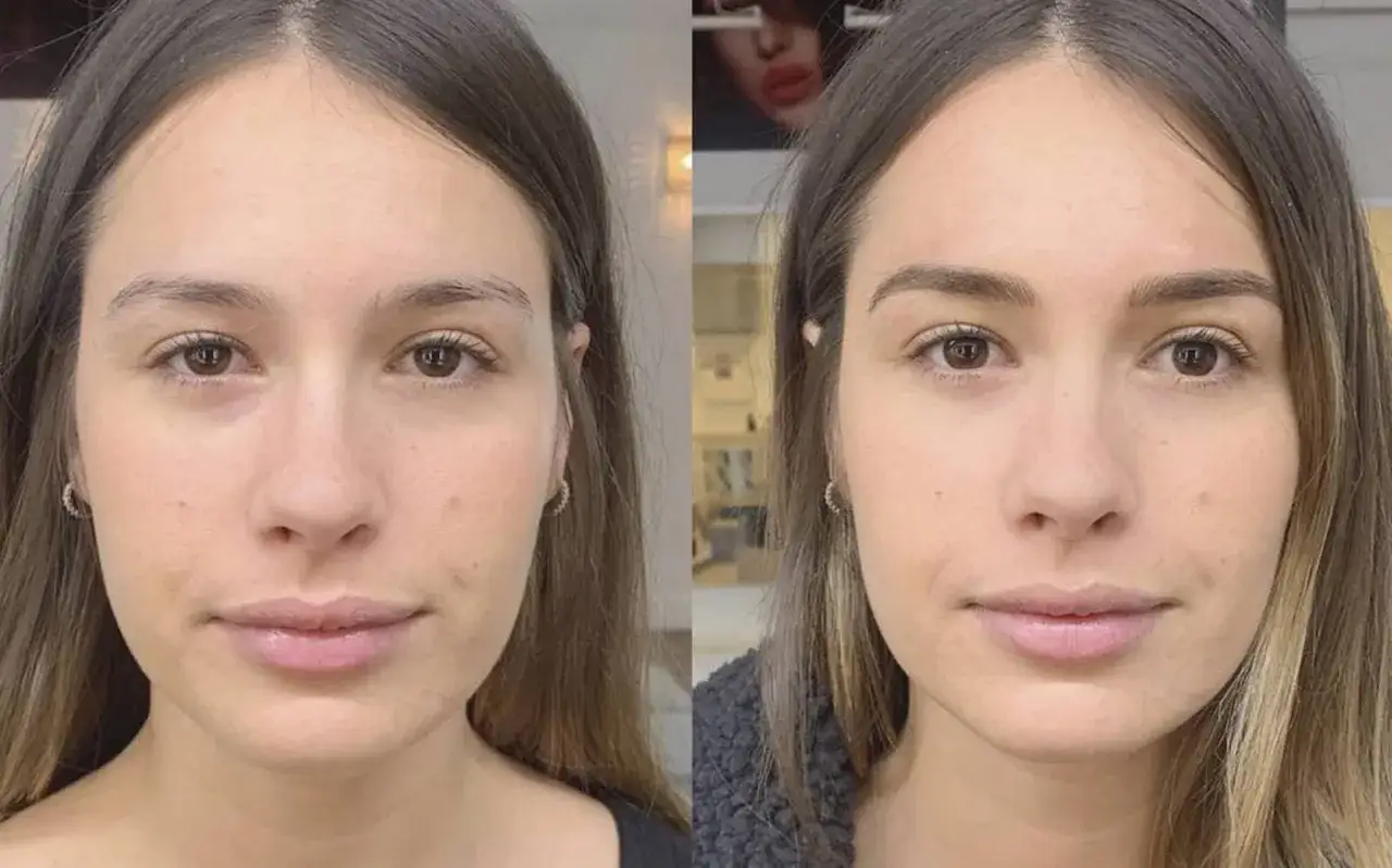 Comparativa de microblading cejas: antes y después. Un rostro con cejas más definidas y pobladas tras el tratamiento.