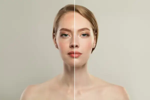 Comparativa de diatermia facial antes y después: piel más lisa y luminosa.