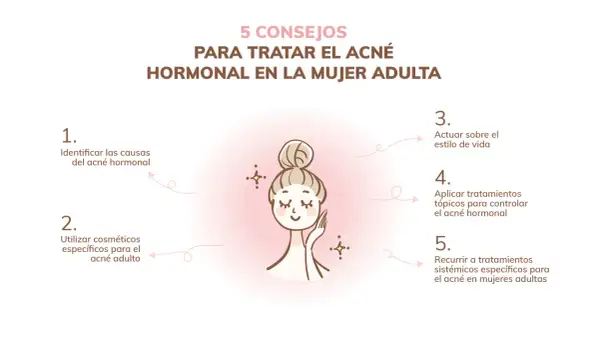 Ilustración de mujer con consejos para el acné hormonal en mujeres adultas: identificar causas, usar cosméticos, estilo de vida, tratamientos tópicos y sistémicos.