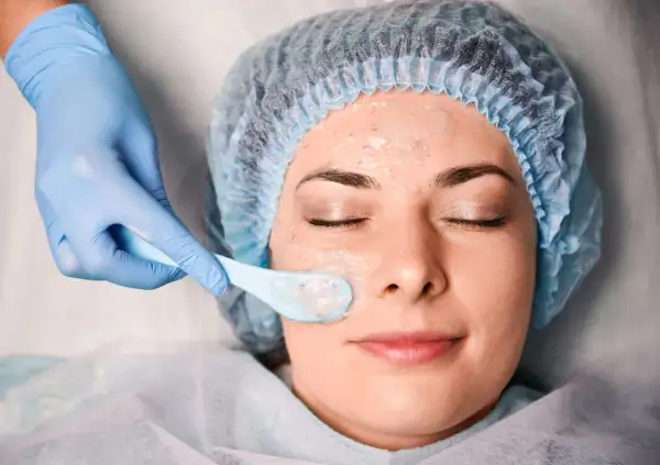 Una mano enguantada aplica una mascarilla en el rostro de una mujer, parte de un tratamiento de peeling químico para renovar la piel.