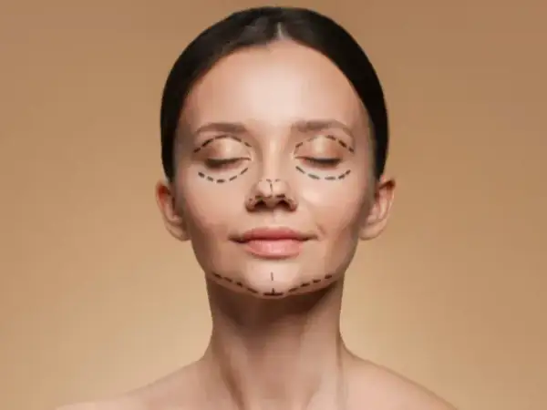 Mujer con líneas de marcador en el rostro, indicando áreas para cirugía estética. Se busca corregir la asimetría facial para una apariencia más armoniosa.